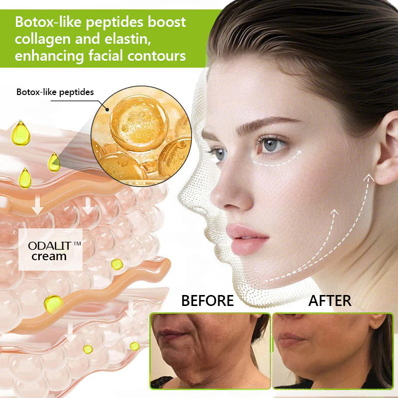 [🔥Posledný deň so 70% zľavou] ODALIT™ Botox a retinolový injekcia - redukuje hlboké vrásky, ochabnuté líce a opuchnuté oči
