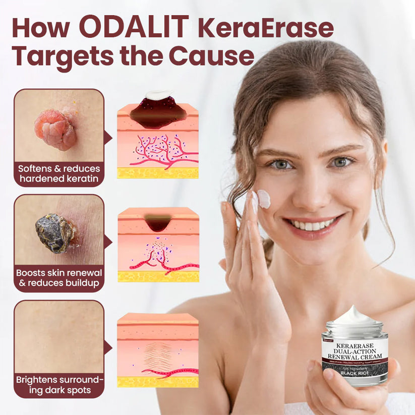 ✅Bleskový výpredaj - ODALIT®KeraErase regeneračný krém s dvojitým účinkom