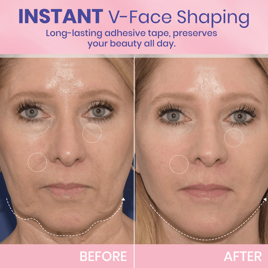 💖🎁Posledný deň so zľavou 50 % – neviditeľná lepiaca páska Aweiya™ V-Face Lifting